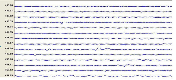 La explotación minera Ropes el detector de metales ultrasónico/el equipo de prueba ultrasónico portátil